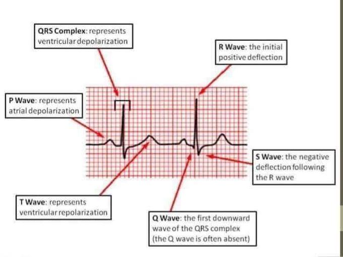 ECG basic