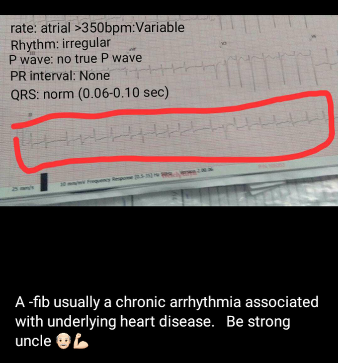 Electrocardiogram