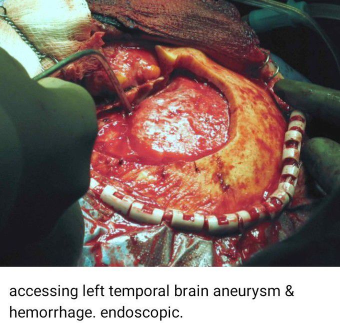 Neurosurgery