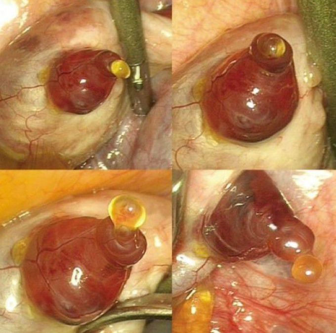 THE MOMENT OF OVULATION