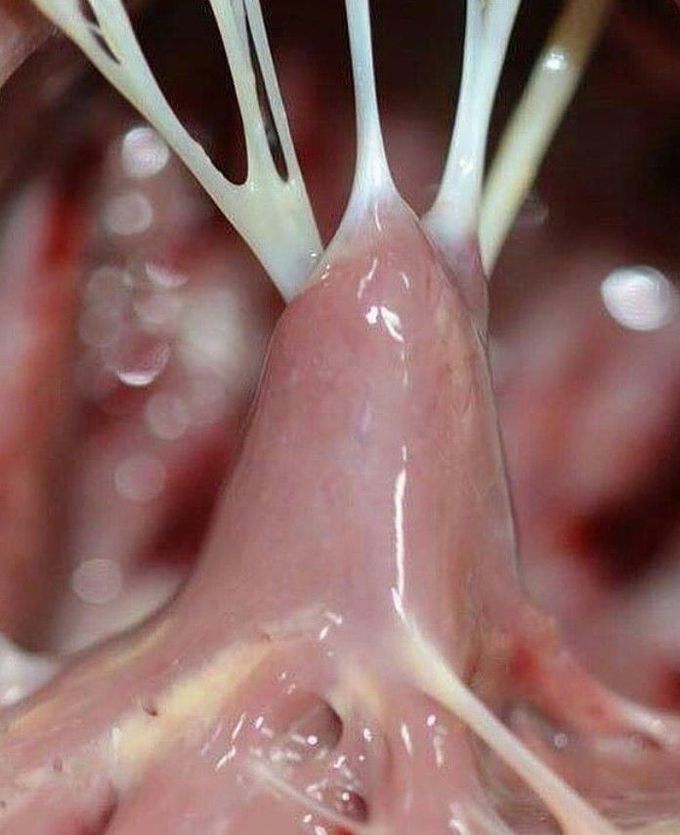 Amazing shot of chordae tendinae