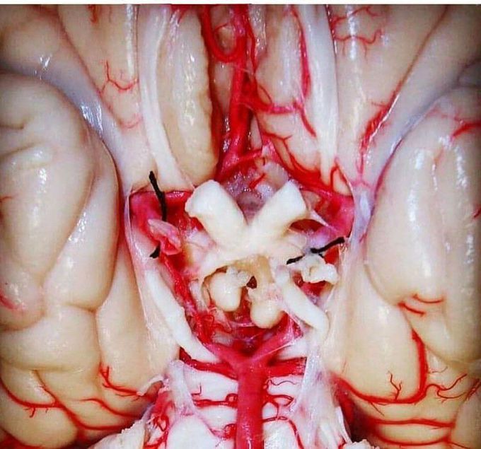 Guess this!