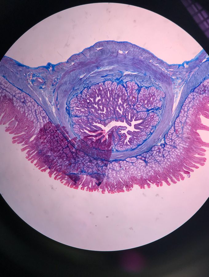 Duodenum under the microscope - MEDizzy