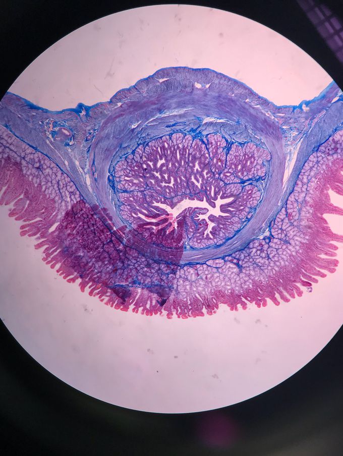 Duodenum under the microscope