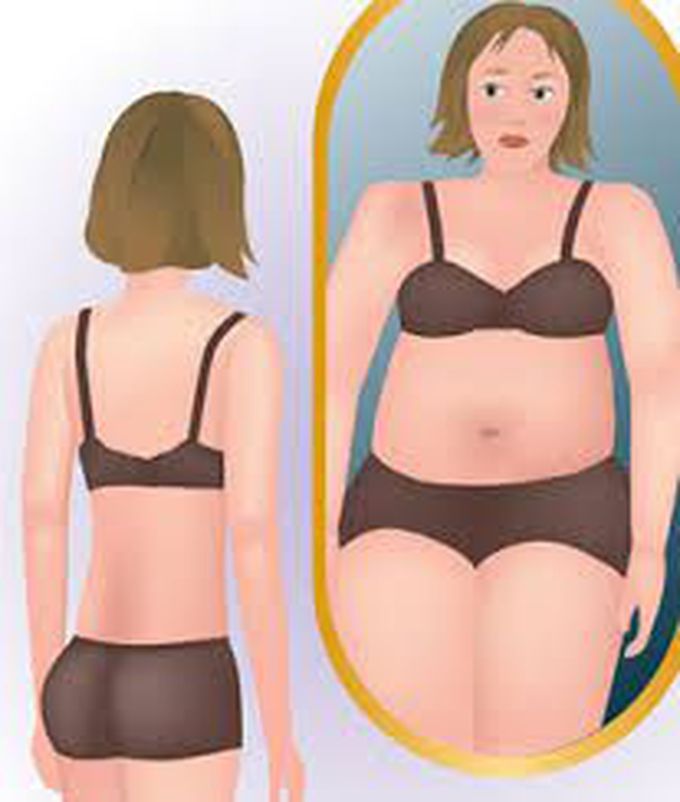 Anorexia Nervosa