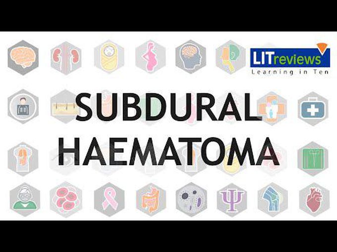 Sub-dural Hematoma: Clinical Review