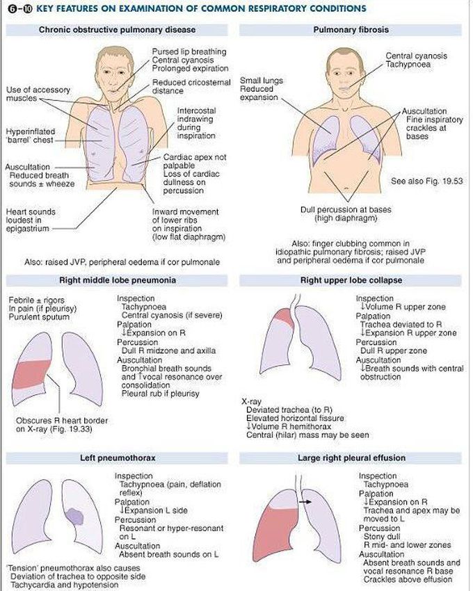 Respiratory conditions