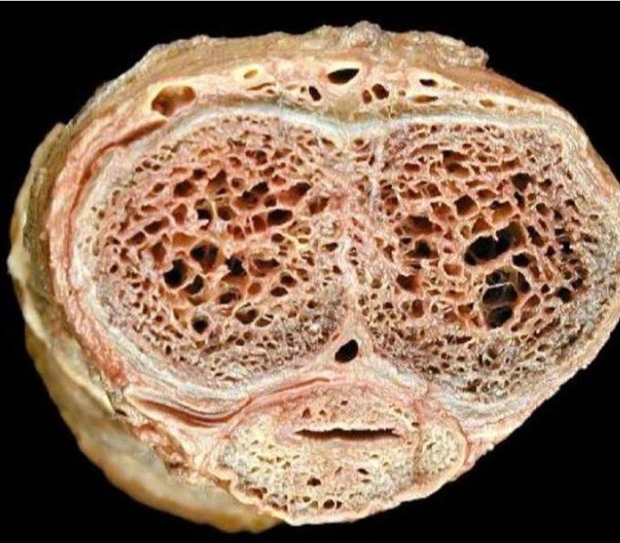 Cross Section of Penis