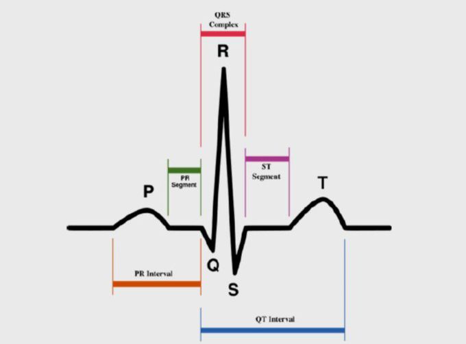 ECG wave