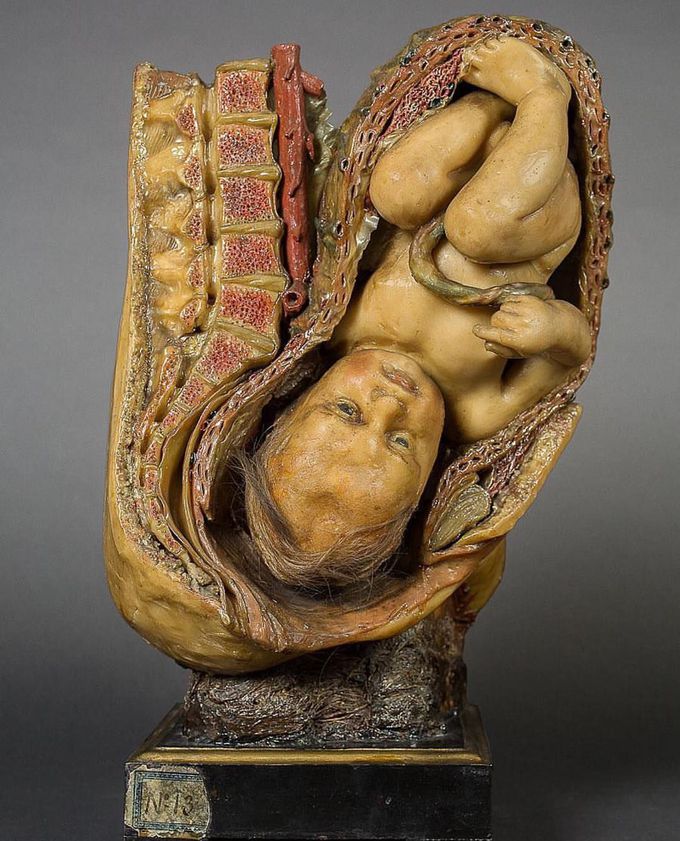 Fetus waxy model