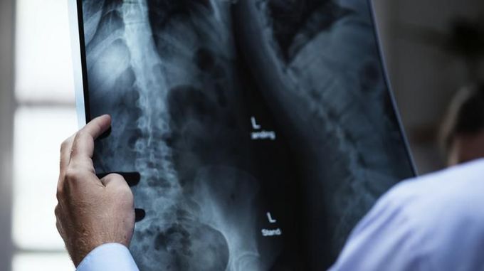 Israel performs first surgery to regrow a bone