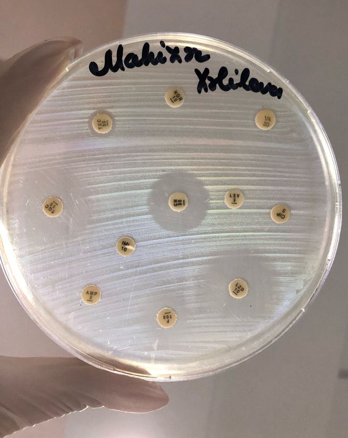 Rectal swab, Vankomycin and Teicoplanin RESISTANT Enterococcus faecium