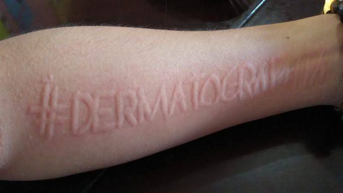 writing on the skin