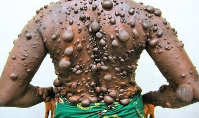 What's your diagnosis??