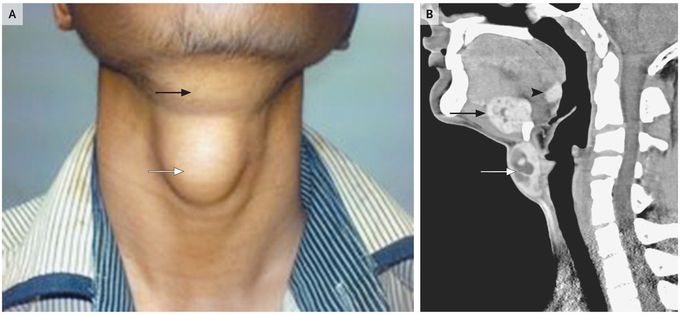 Case Report