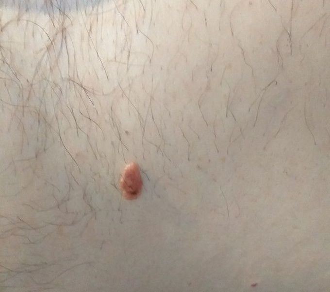 What is your diagnosis?