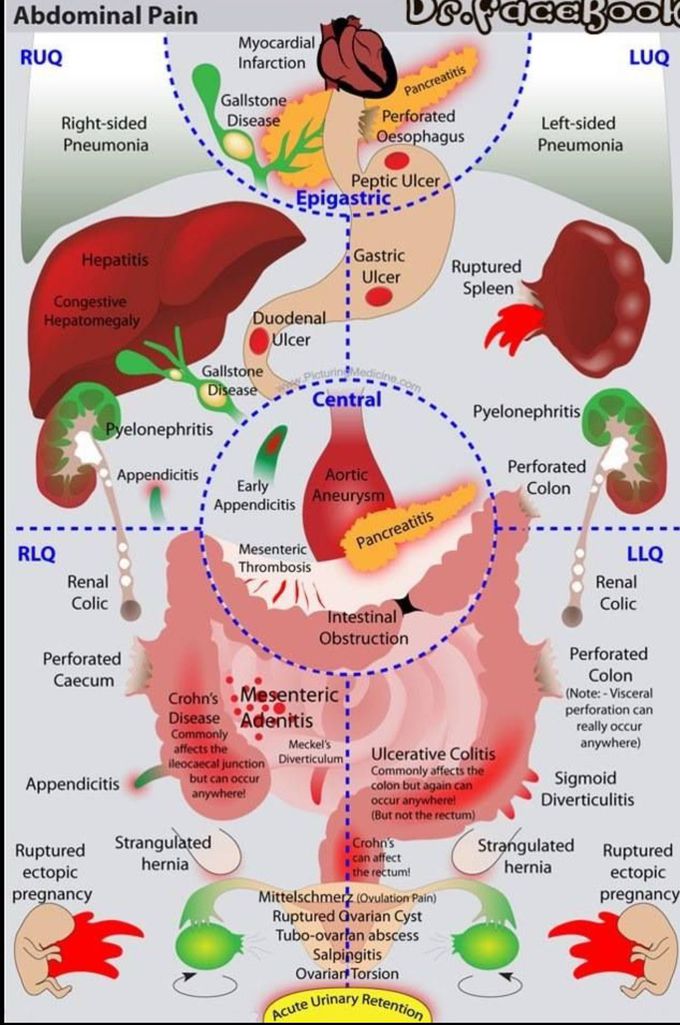 Abdominal Pain