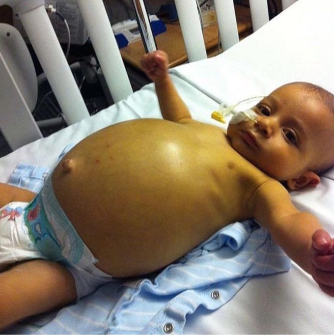 What is your diagnosis