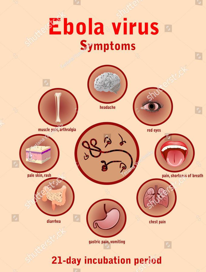 Ebola Virus Disease