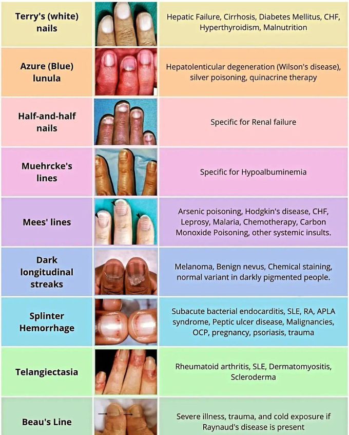 Hand Examination