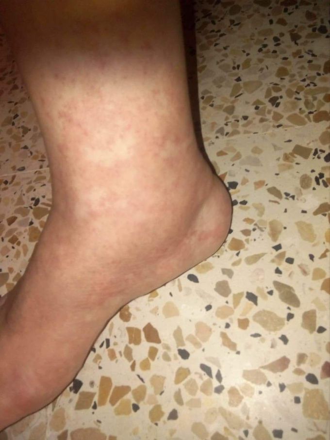 What is your diagnosis ?