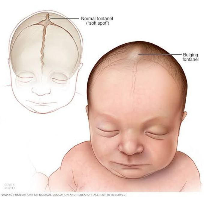 Causes of encephalitis