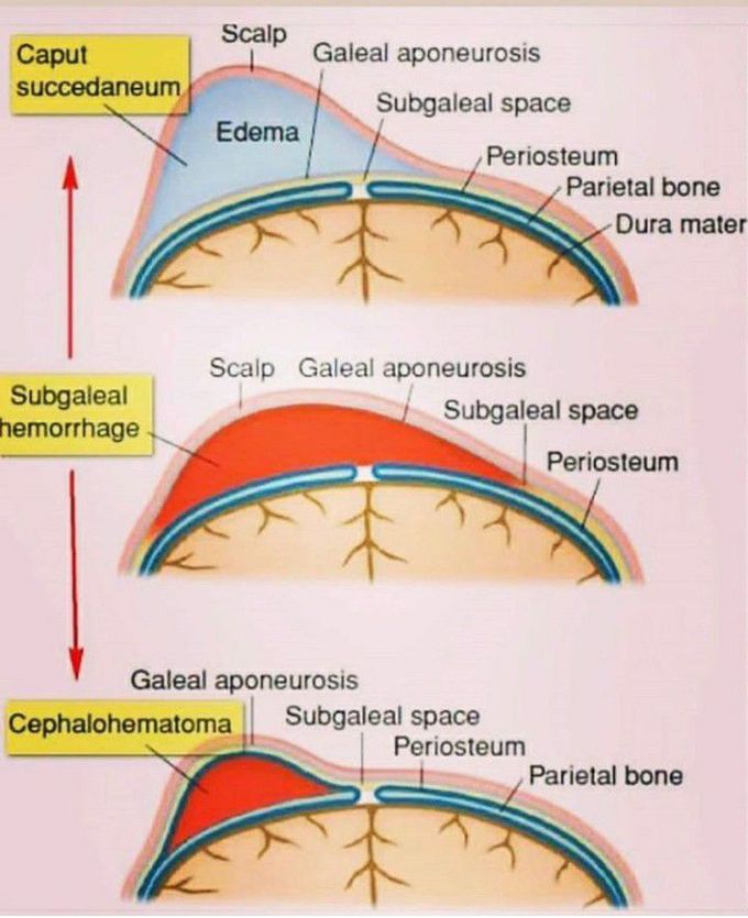 Differential diagnosis of head examination of neonate.
