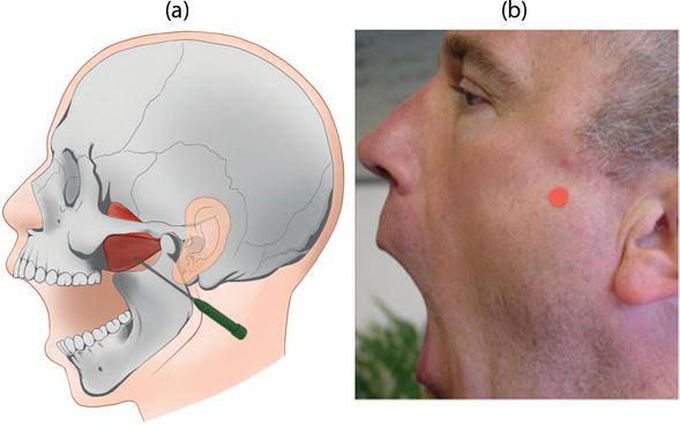 Oromandibular dystonia