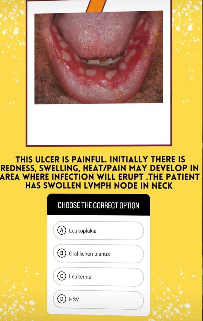 Guess the Oral Lesion