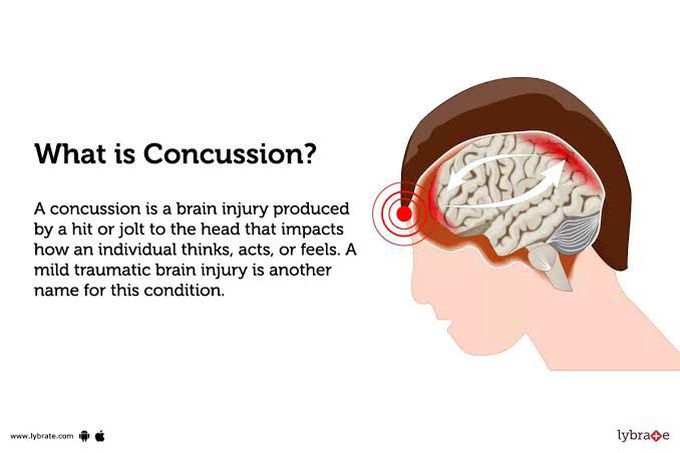 What is concussion