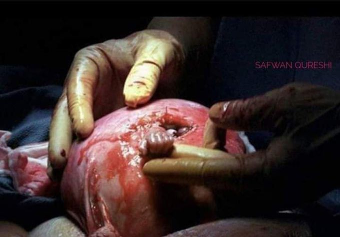 "Hand of hope"
