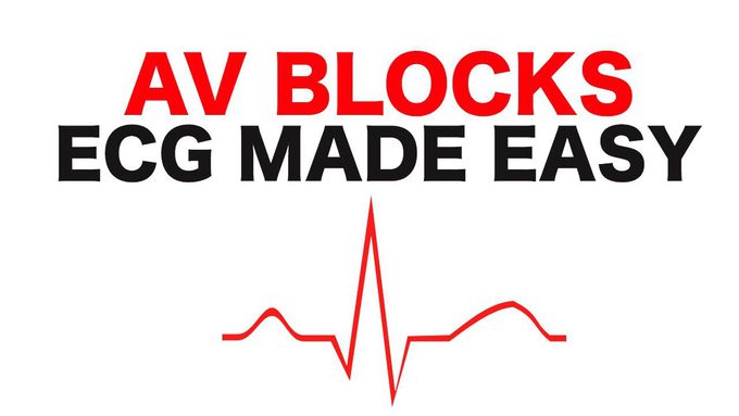 AV Blocks