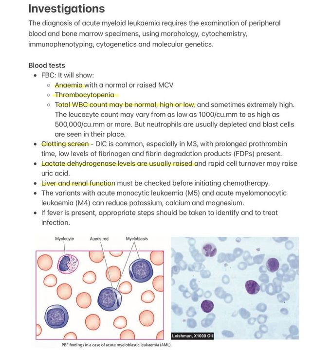 Acute Myeloid Leukemia V