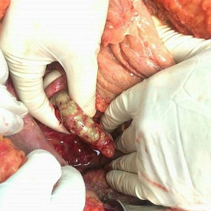 Which surgery goin on ?