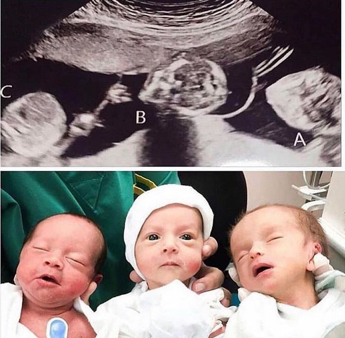 Beautiful 3 newborn
