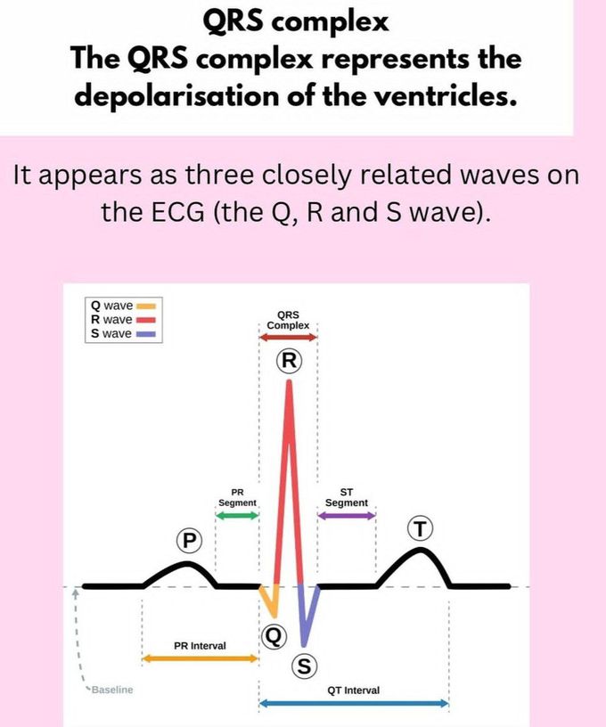 QRS Complex