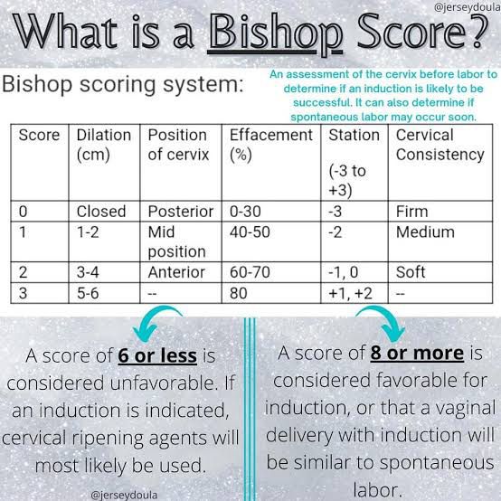 Bishop Score Table - MEDizzy