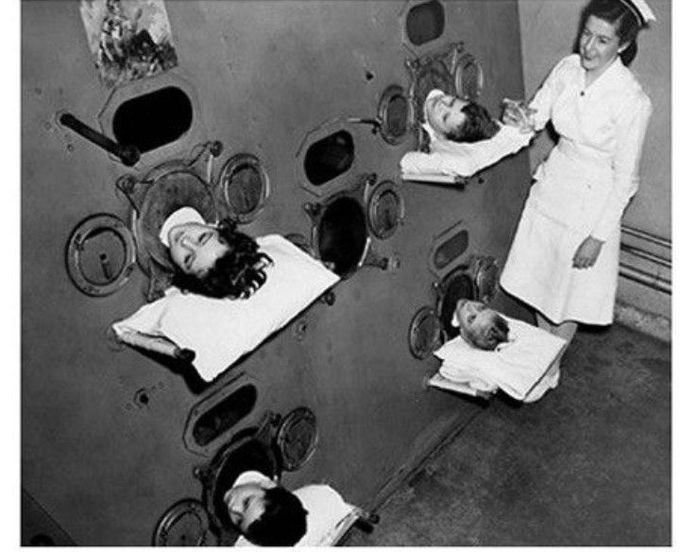 Children in iron lung before the advent of polio vaccination. Many children lived for months in these machines, thought not all survived. c.1937

Polio vaccine was invented in 1950s.