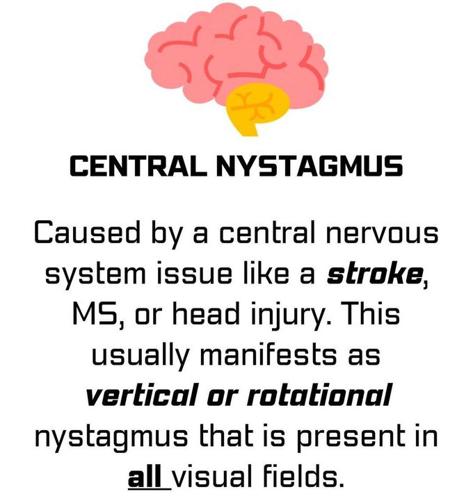 Nystagmus Types I