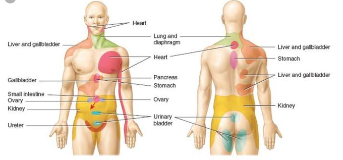 Referred pain sites