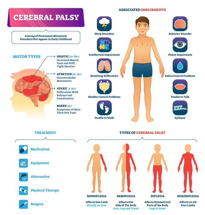 Treatment for Cerebral palsy