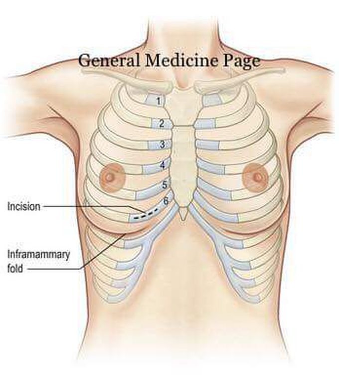 Female Breast Anatomy - MEDizzy