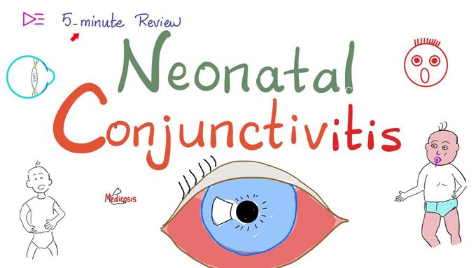 Neonatal Conjunctivitis | Ophthalmia Neonatorum