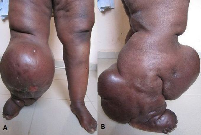 What is your diagnosis?