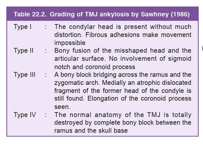 Tmj ankylosis grading