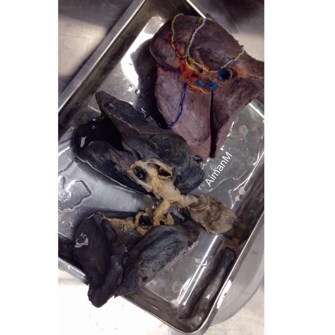 General anatomy/surgery