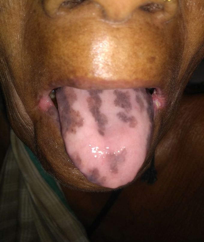 What is the diagnosis?