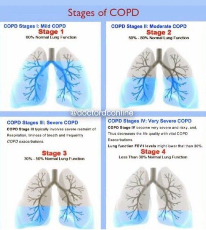 Chronic abstructve pulmonary D