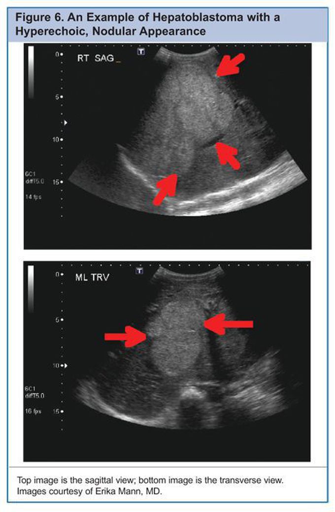eRADIMAGING ASRT Accredited ARRT CE Courses