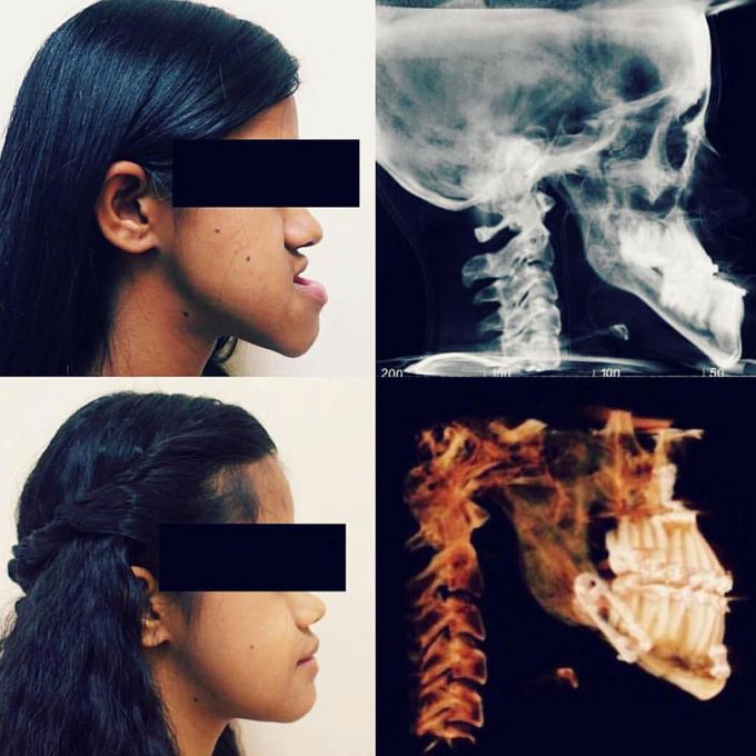 Amazing Surgery!